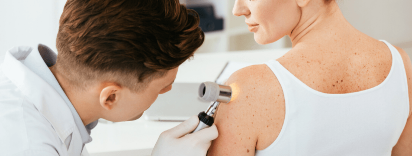 Developing A Second Melanoma