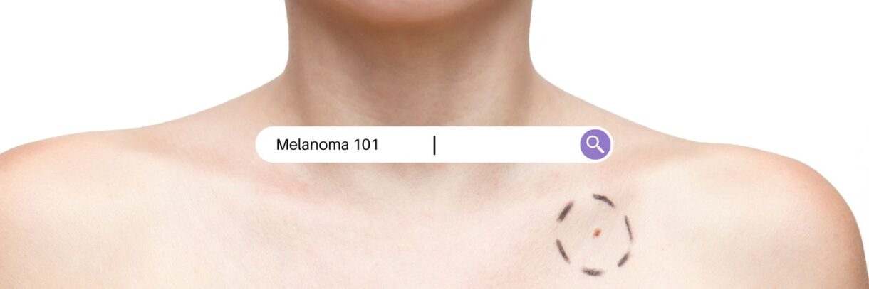 Melanoma 101 with Melissa Wilson