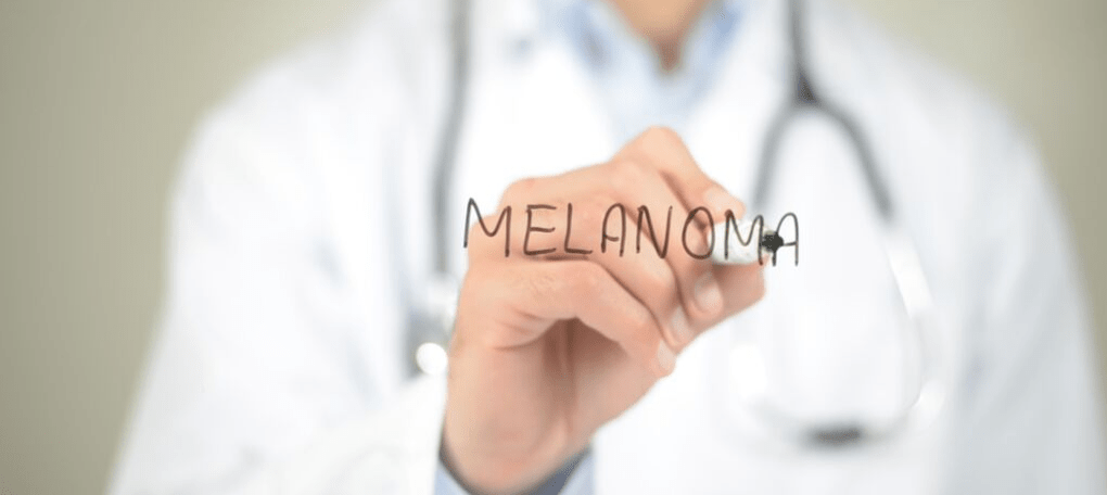 Melanoma 101