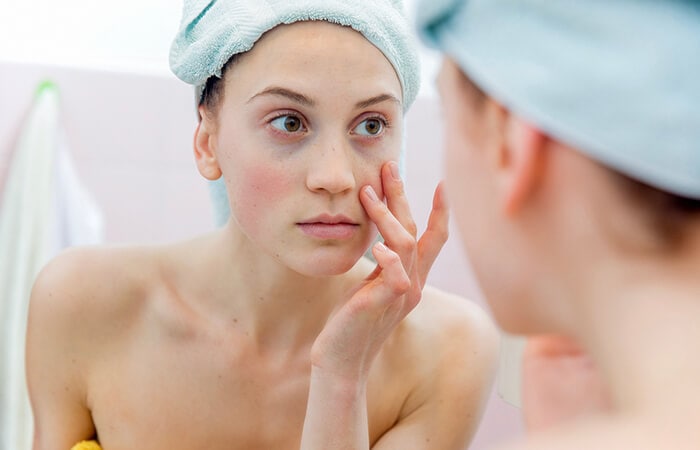 How To Do a Skin Self-Examination